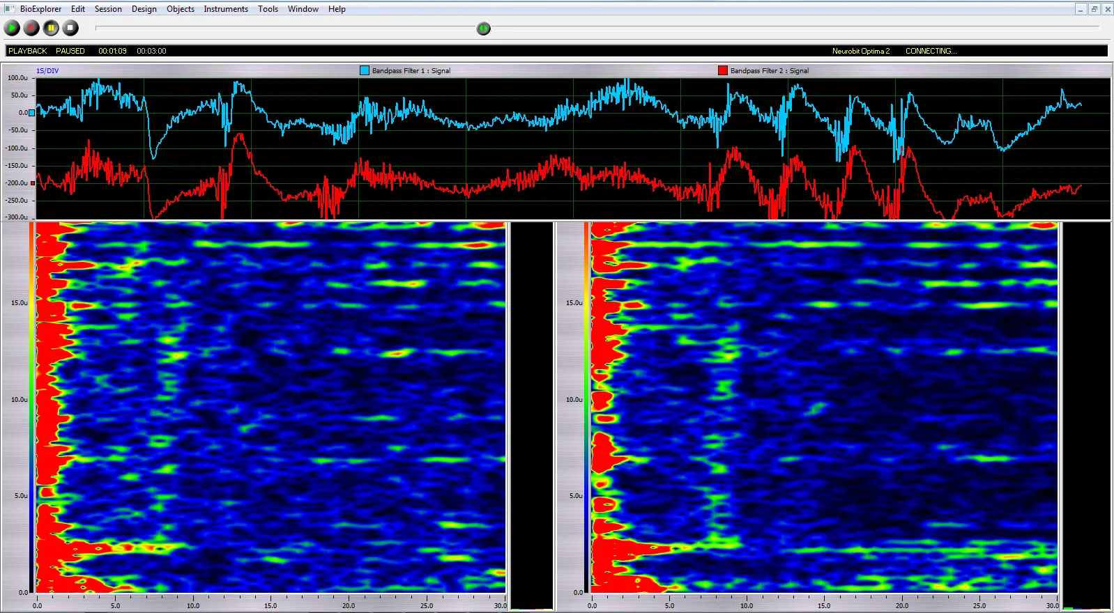 Ejemplo de análisis tiempo-frecuencia de un registro EEG